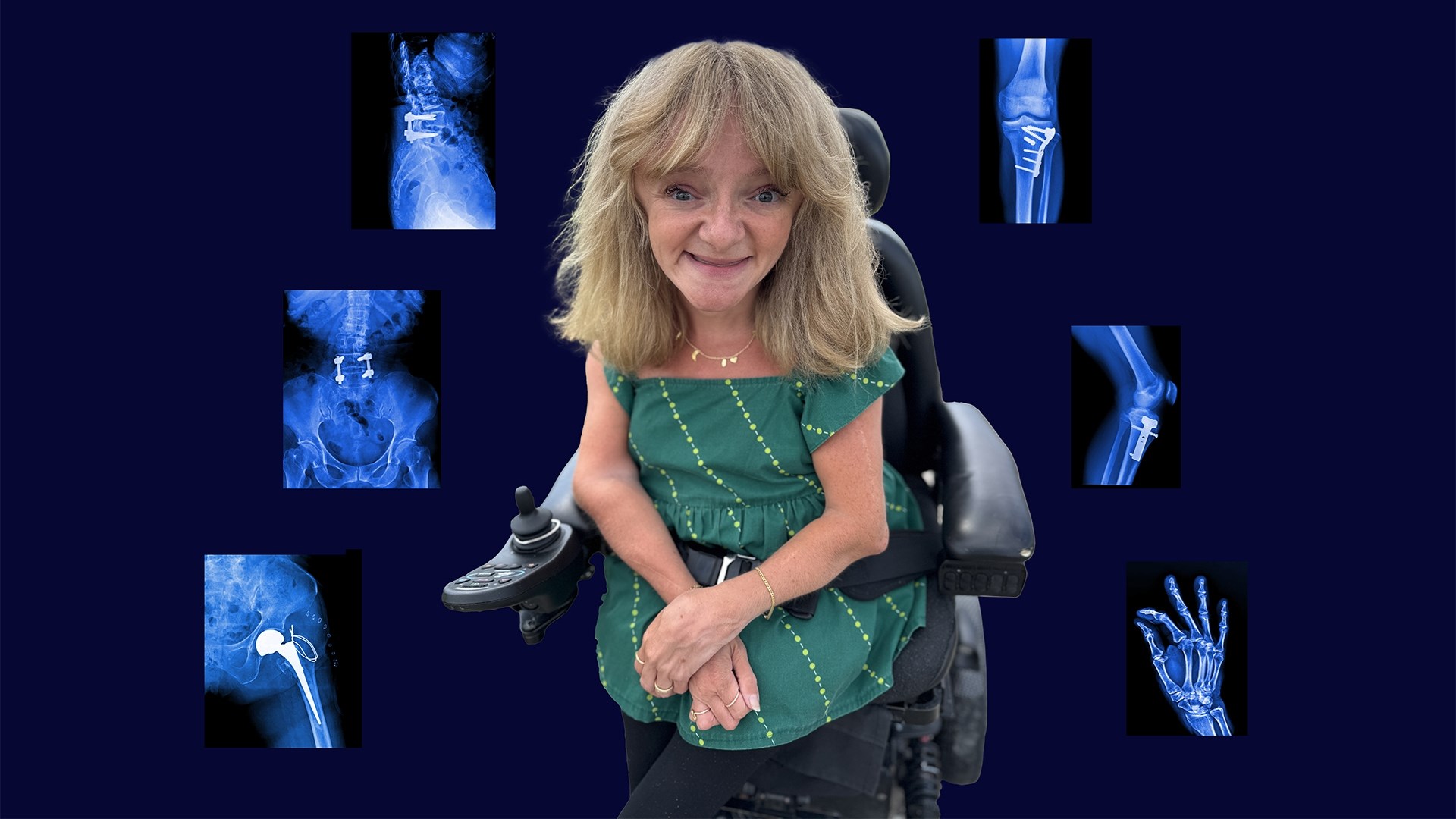 Pigen med knogler af glas