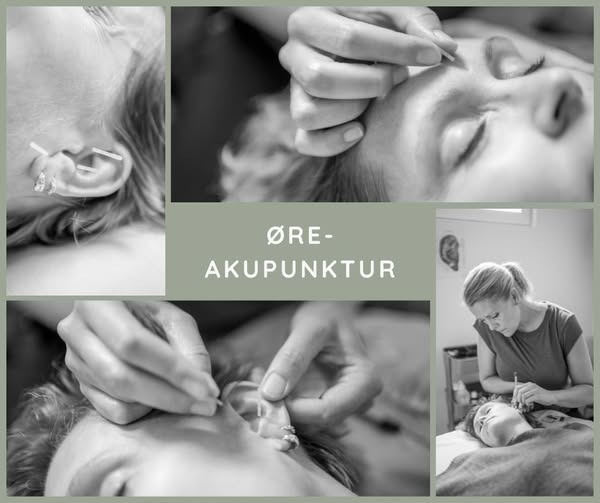 Zones By Gitte fremhæver fordelene ved øreakupunktur som individuel behandlingsmetode