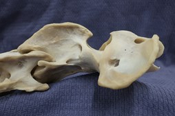 Osteopati og kranio-sakral terapi: Foredrag om kroppens spændinger