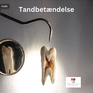 Opslagsbillede