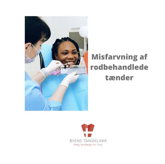 Byens Tandklinik i Struer forklarer om misfarvning og behandling af rodbehandlede tænder