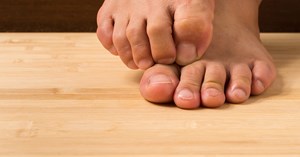 Ikast Apotek: Sådan genkender og behandler du fodsvamp