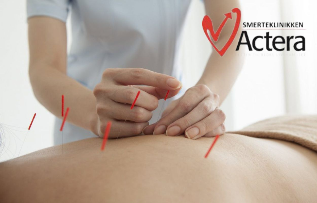 Actera Klinik Aarhus tilbyder nu fedtfrysning og nye behandlingsformer