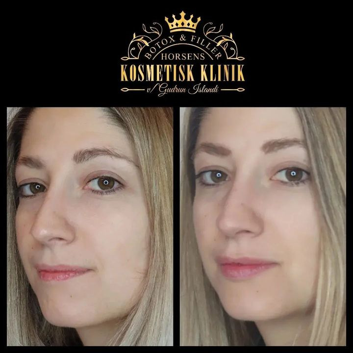 Opslagstavlen: Nyeste opdateringer fra Horsens