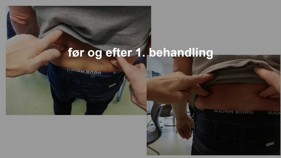 Bjørks Terapi og Velvære tilbyder efterårstilbud på behandling mod kropssmerter