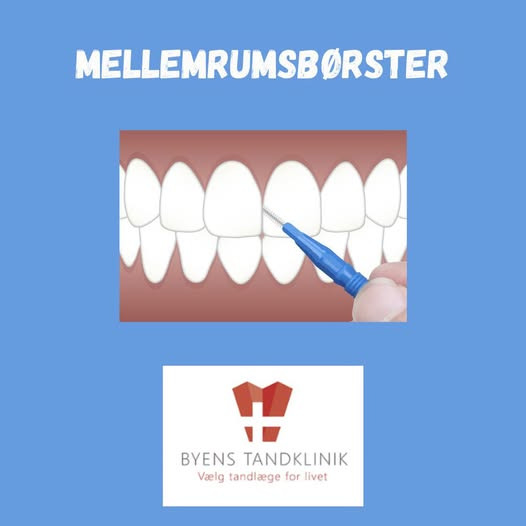 Byens Tandklinik i Struer anbefaler mellemrumsbørster som alternativ til tandtråd