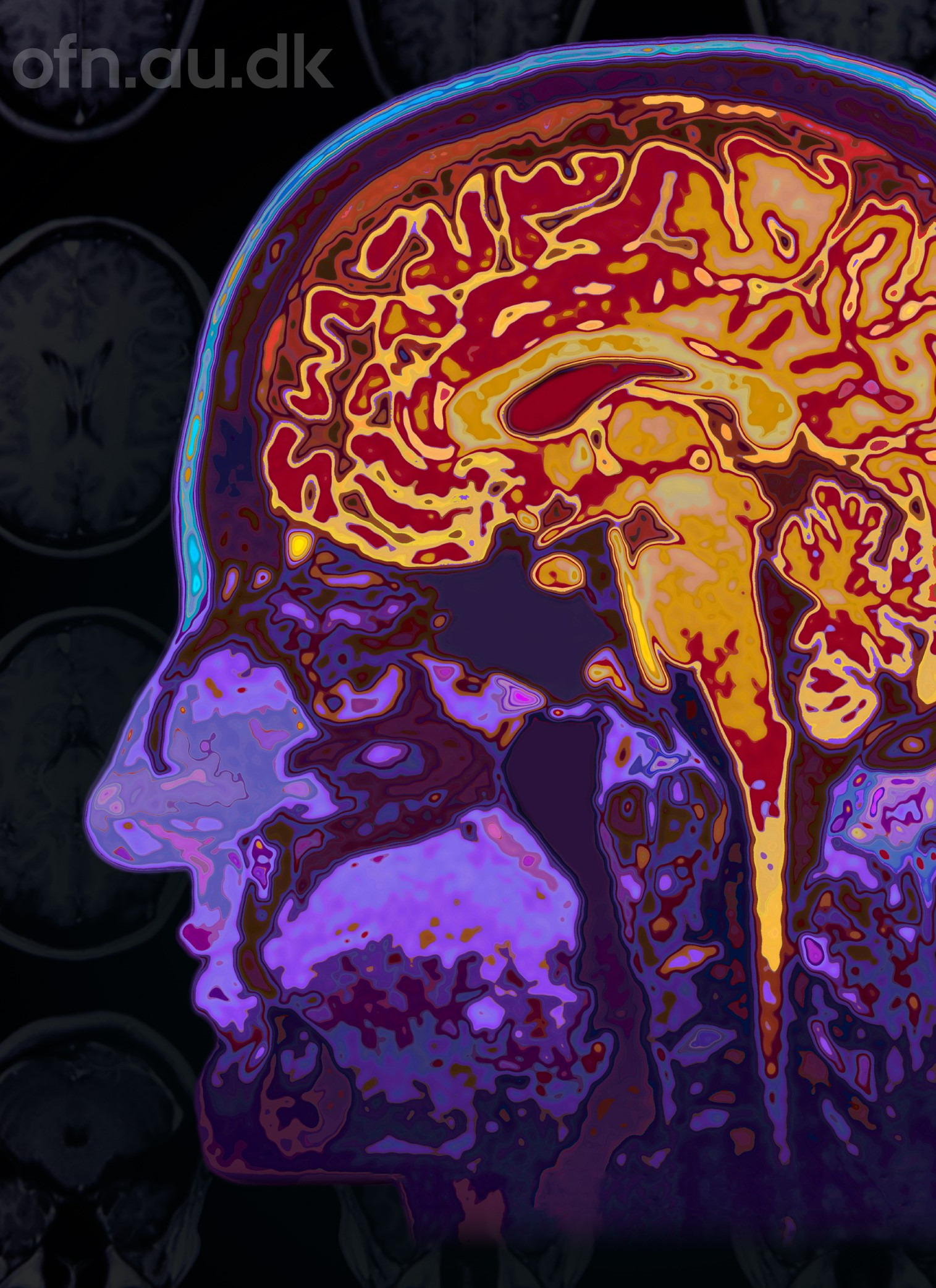 Find mening med livet gennem ny hjerneforskning i Herlev