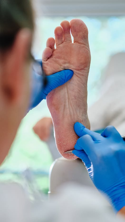 Fodpleje ved Kiss: Overgangsalderens påvirkning på dine fødder og hvordan du håndterer det