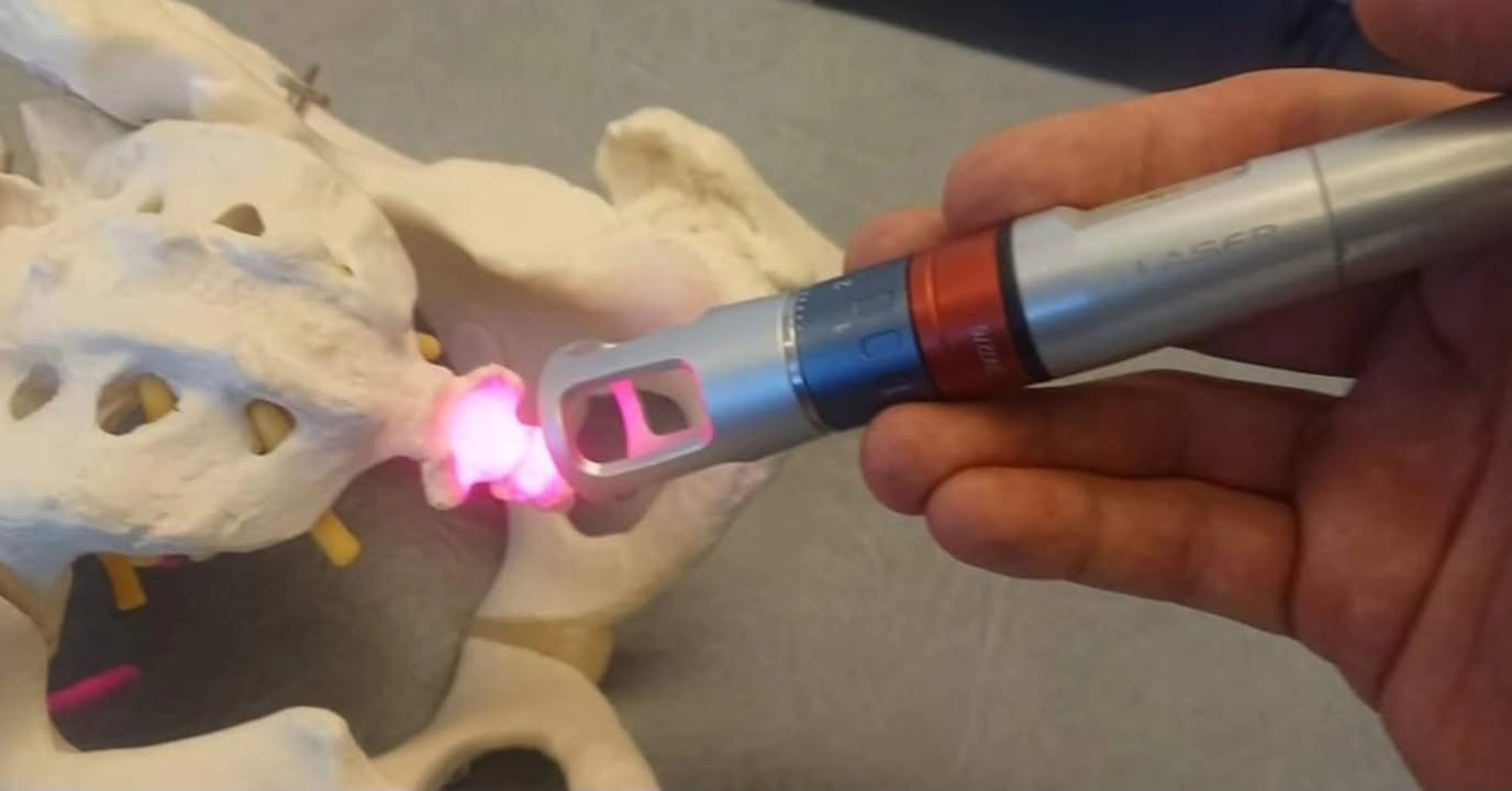 Brandsborgs Kropsterapi tilbyder effektiv behandling af halebenetsmerter