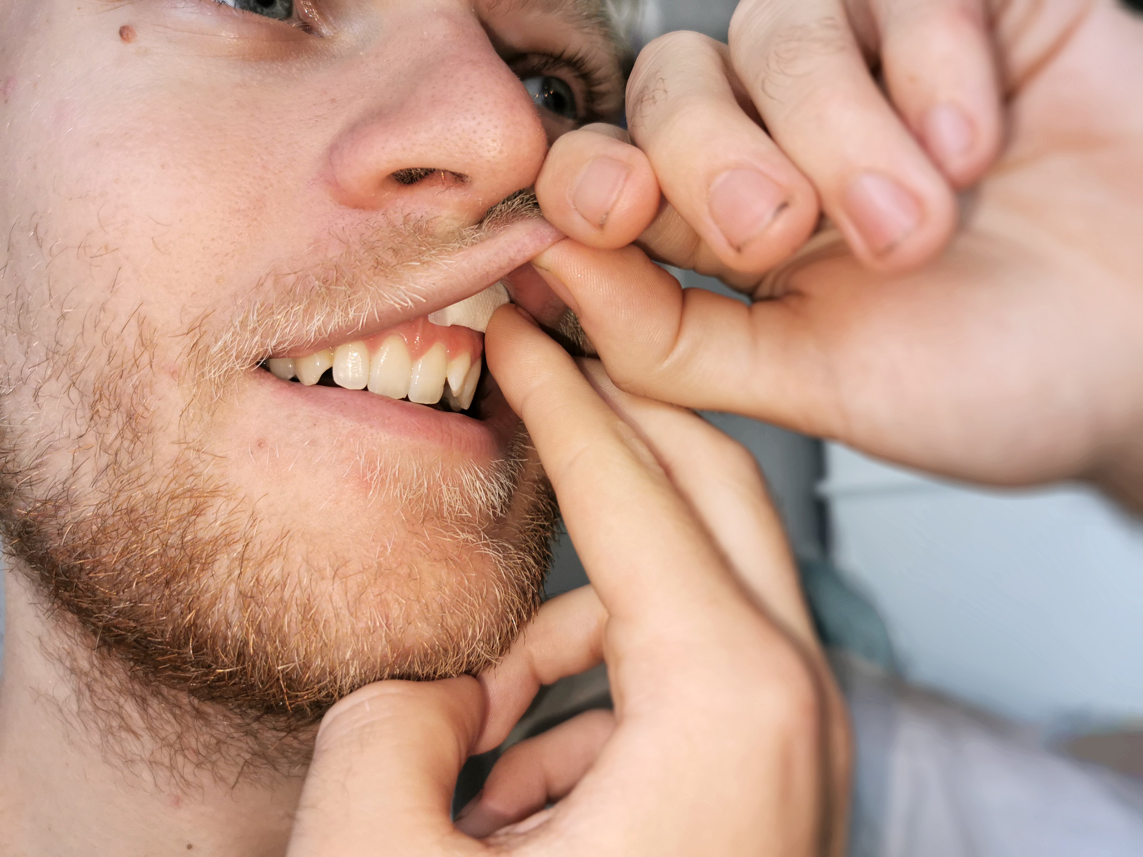 Randers Kommune lancerer "Nikotinfri Ungdom" for at beskytte unge mod nikotinprodukter