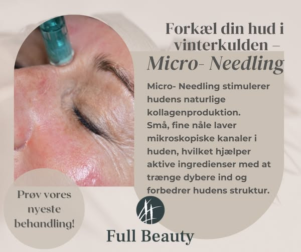 Full Beauty Aalborg introducerer nyhed inden for hudbehandling: Micro-needling