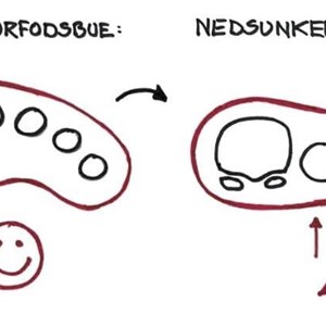 Opslagsbillede