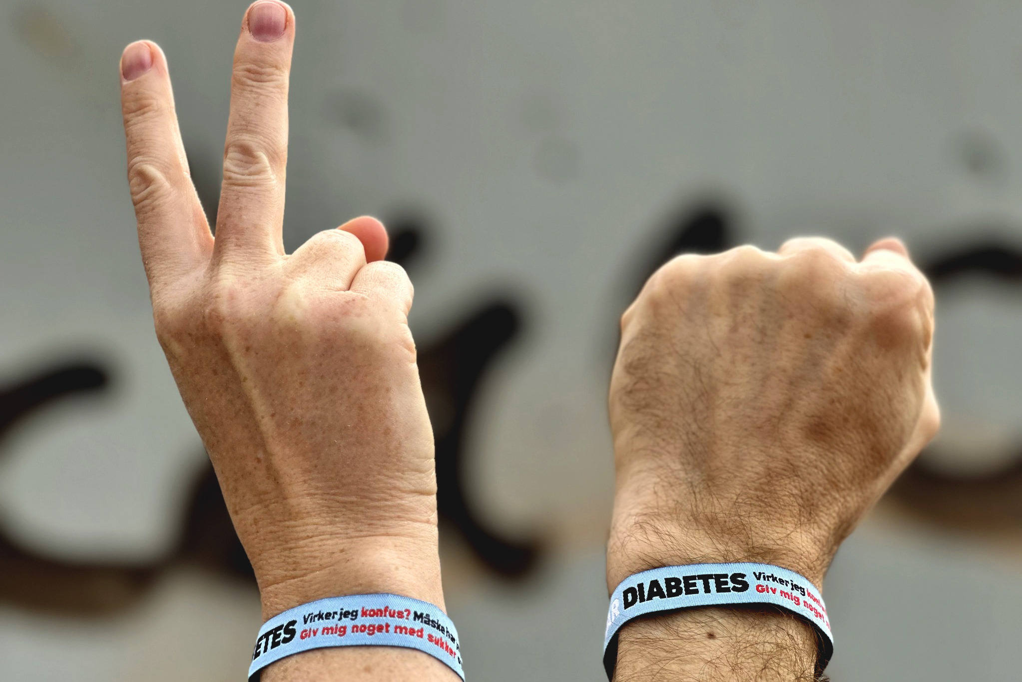 Diabetesarmbånd på Tønder Festival