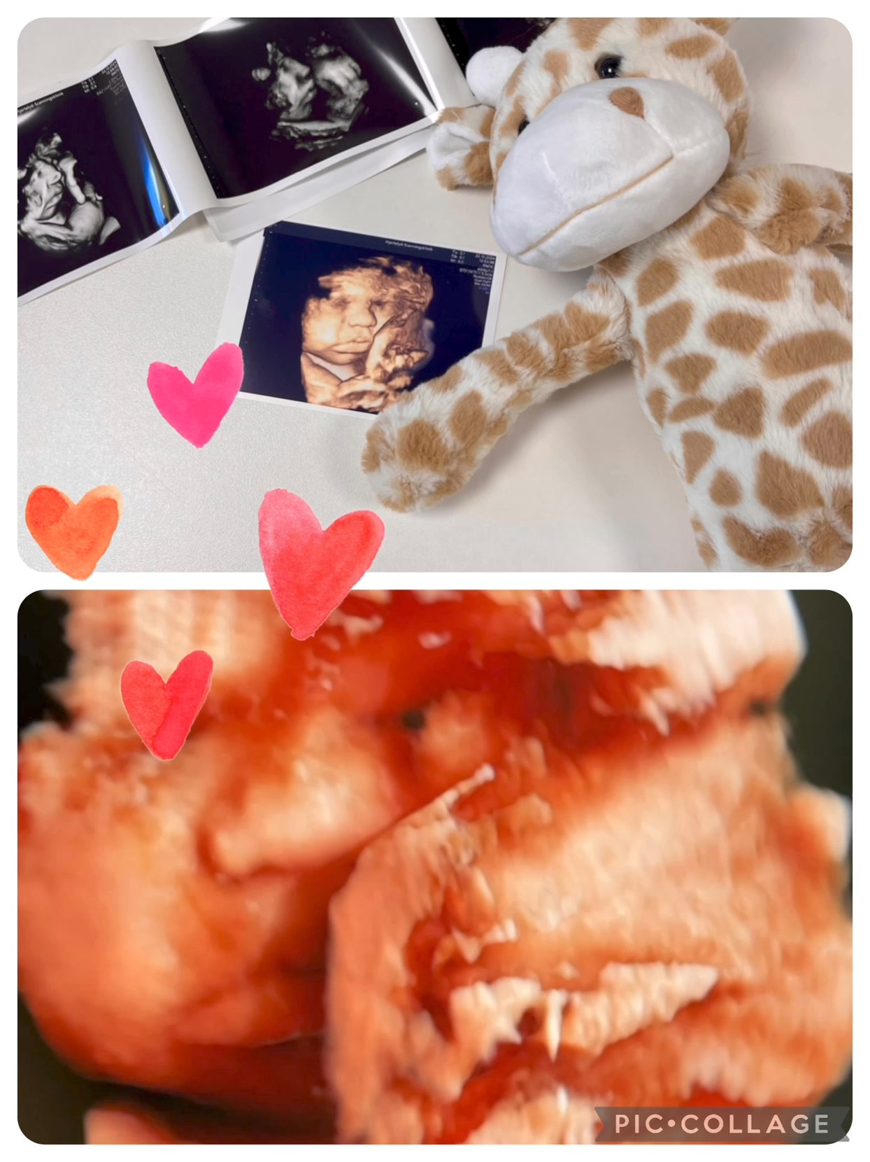 Hjertelyd - scanningsklinik for gravide: Klar til at byde velkommen til ny lillesøster i familie på tre