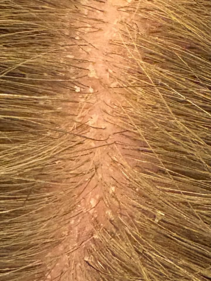 My Style fremhæver transformation med skræddersyet spa behandling for hovedbund