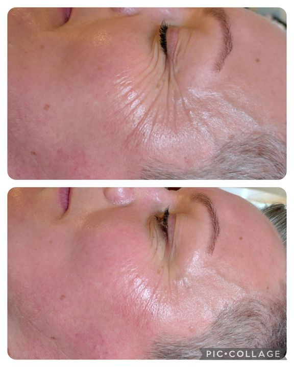 Hold trit med lokalområdet: Nyt fra Skive