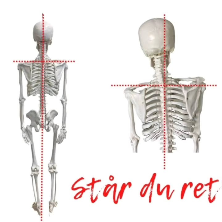 Brandsborgs Kropsterapi afslører skjulte årsager til skævt bækken