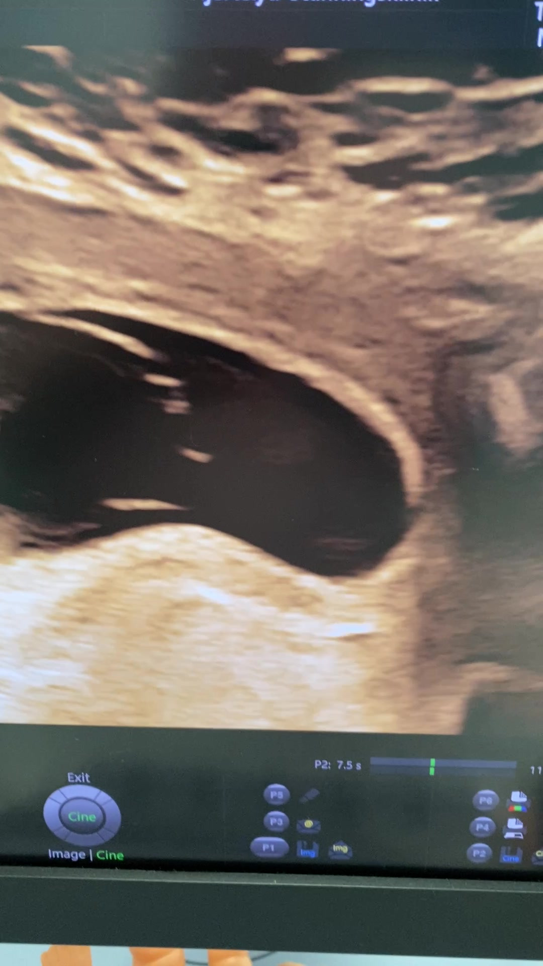 Det nyeste på Ikasts opslagstavle