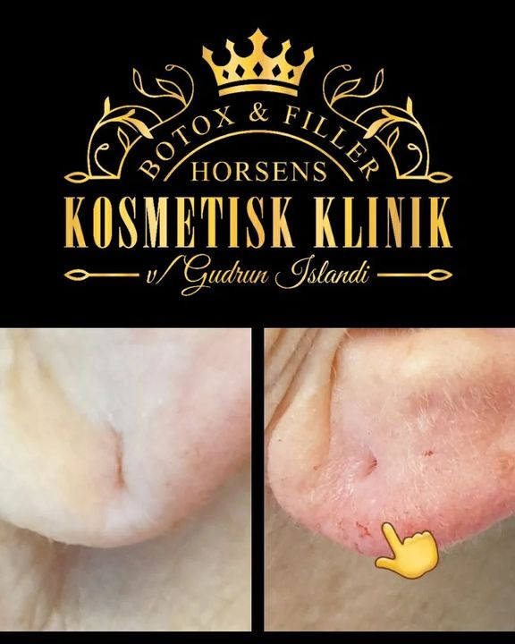 Det nyeste på Horsens’ opslagstavle