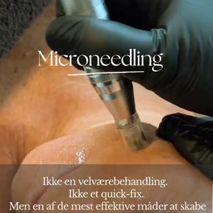 Opslagsbillede
