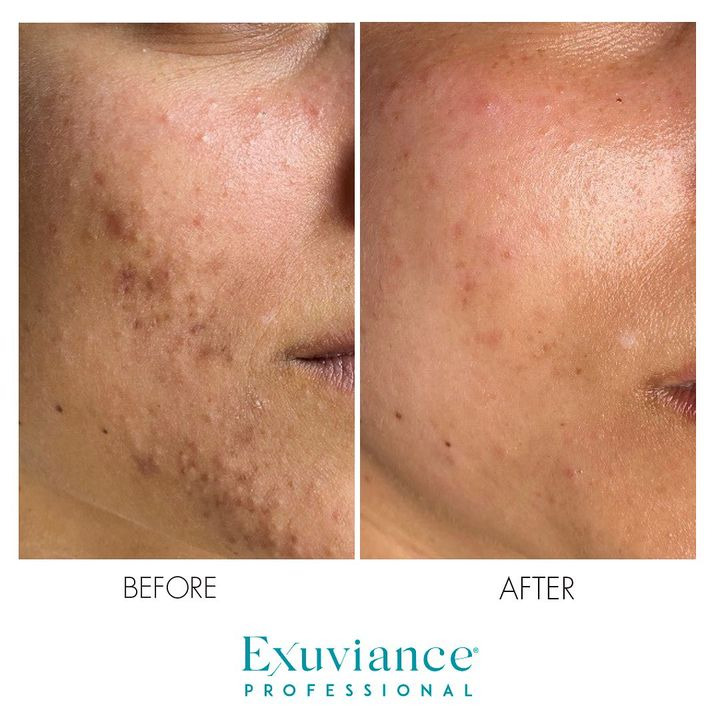 Opslagstavlen: Nyeste opdateringer fra Silkeborg