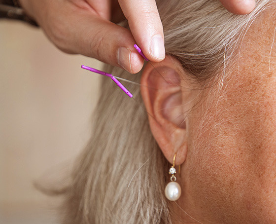 Akupunktør Morten Lopdrup skaber balance og velvære i Hammel og Silkeborg 