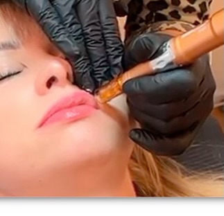 Hair & Skin Zone introducerer ny teknik for naturlig læbevolumen uden filler i Vejle