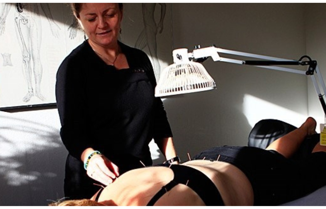 Lades Akupunktur: Nålen til bedre velvære 