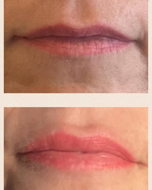 Hair & Skin Zone præsenterer naturlig lip volume uden kirurgi