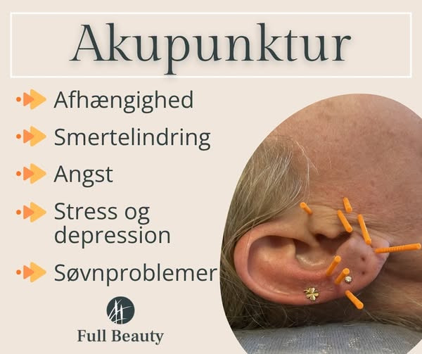 Full Beauty Aalborg tilbyder øreakupunktur som støtte ved smerter, stress og søvnproblemer