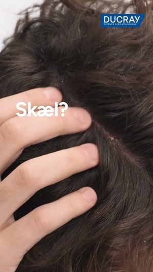 opslagsbillede