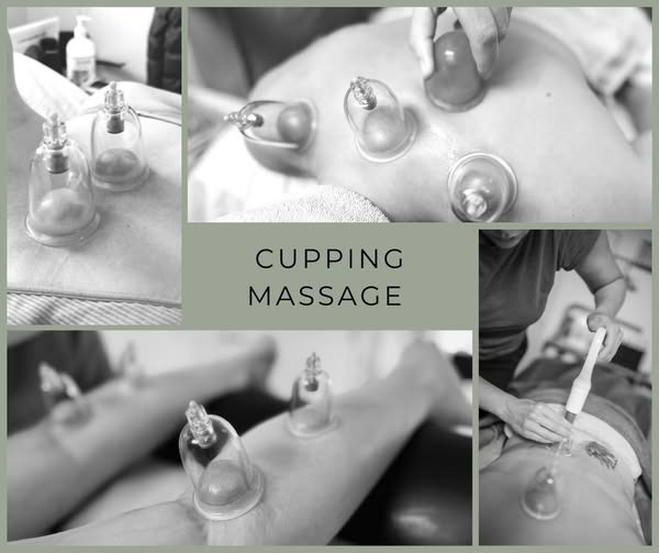 Cupping hos Zones By Gitte lindrer både spændinger og migræne