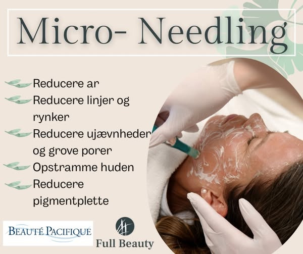 Full Beauty Aalborg tilbyder micro-needling med tre skræddersyede pakker