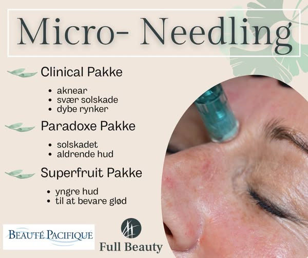 Full Beauty Aalborg tilbyder skræddersyede micro-needling-behandlinger