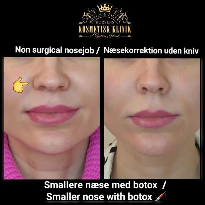 En finger på pulsen i Horsens