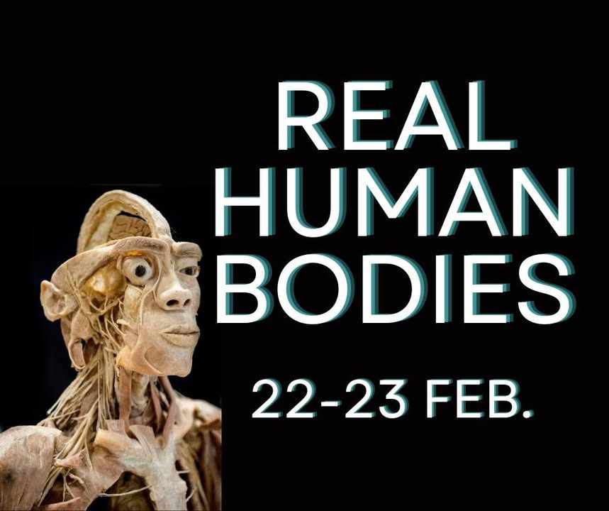 Frændes Madværk informerer: Vi udlejer blot lokalet til Real Human Bodies-udstilling