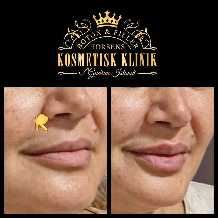 Se dagens updates fra Horsens her