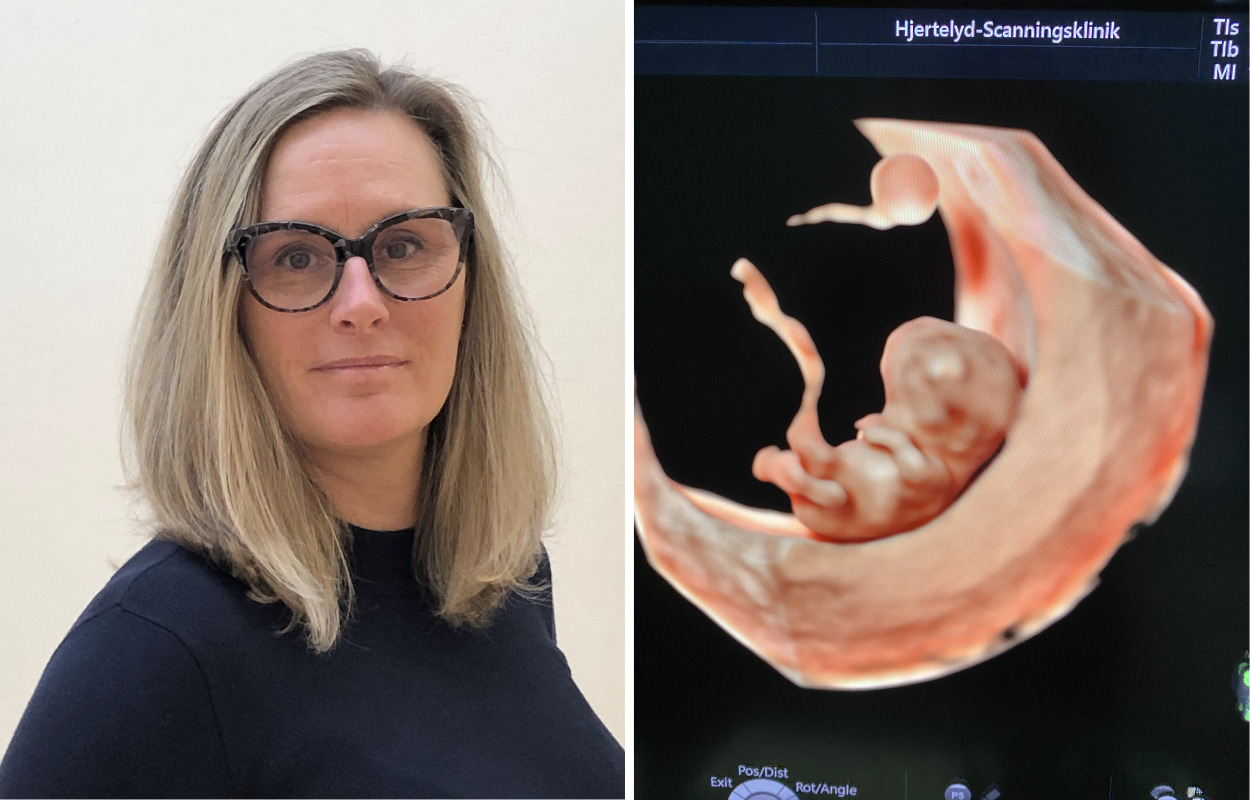 Helle har smurt gelé på 50.000 maver igennem snart to årtier: "Det er vigtigt, at gravide par føler sig set"