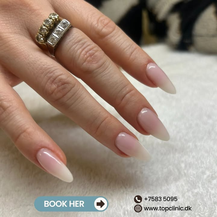 Top Clinic lancerer tilbud på manicure med Shellac, Plexigel og gelénegle