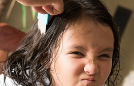 Opfordring til alle forældre: Kæm dit barn for lus på fredag!