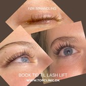Top Clinic introducerer Lash Lift for naturligt løft af dine vipper