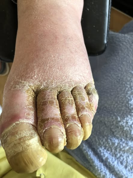 Fodterapeutisk Klinik v/Lajla Andersen tager vare på fødder, når det ikke længere er muligt