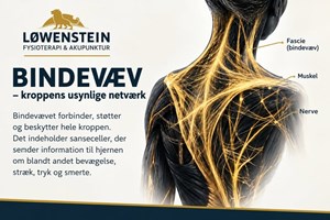 opslagsbillede