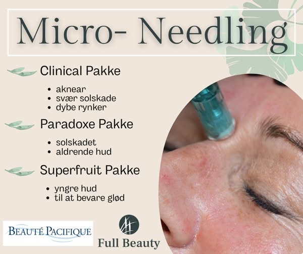 Full Beauty Aalborg introducerer tre nye micro-needling behandlinger for optimal hudpleje