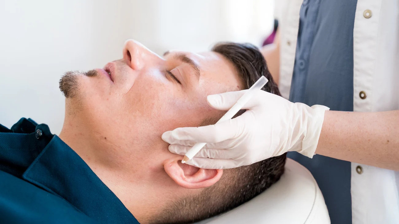 Botox til mænd: Er behandlingen for alle?