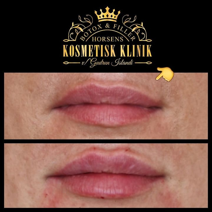 Opdatér dig her: Det nyeste fra Horsens