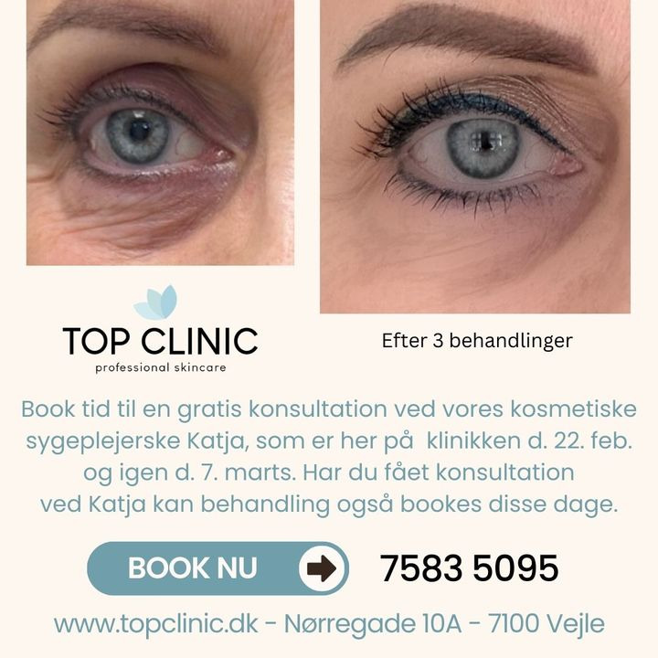 Se dagens updates fra Vejle her