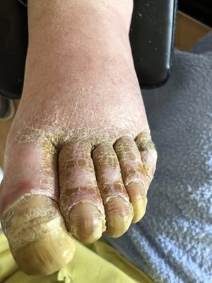 opslagsbillede