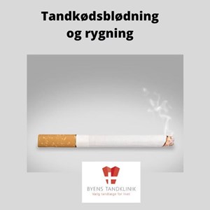 Opslagsbillede
