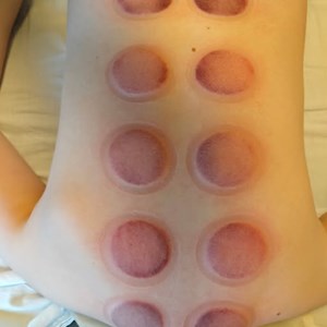 Opslagsbillede